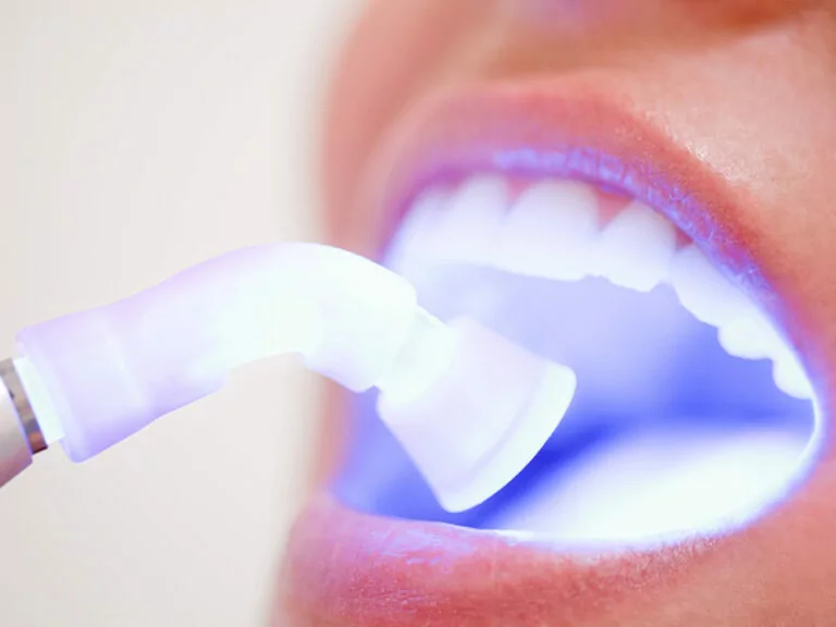 The image shows a close-up of a mouth with a dental instrument that has a laser being used during a dental procedure.