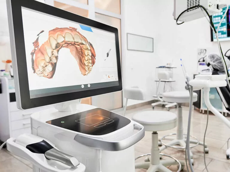 The image shows a modern dental office featuring a digital dental scanner and a computer screen displaying a 3D model of a dental arch.